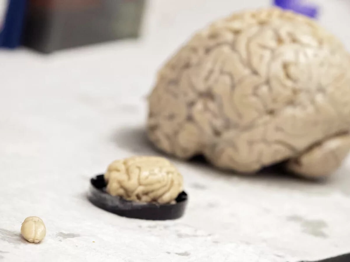 Por que não dormir direito faz seu cérebro ‘comer ele mesmo’?