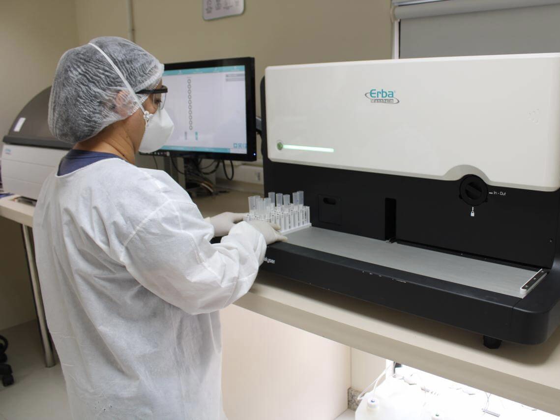 Avanços na Uroanálise: CDG Investe em inovação com o Laura XL