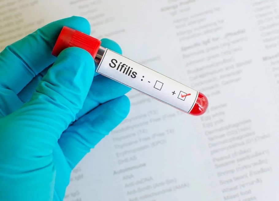 Teste positivo para sífilis