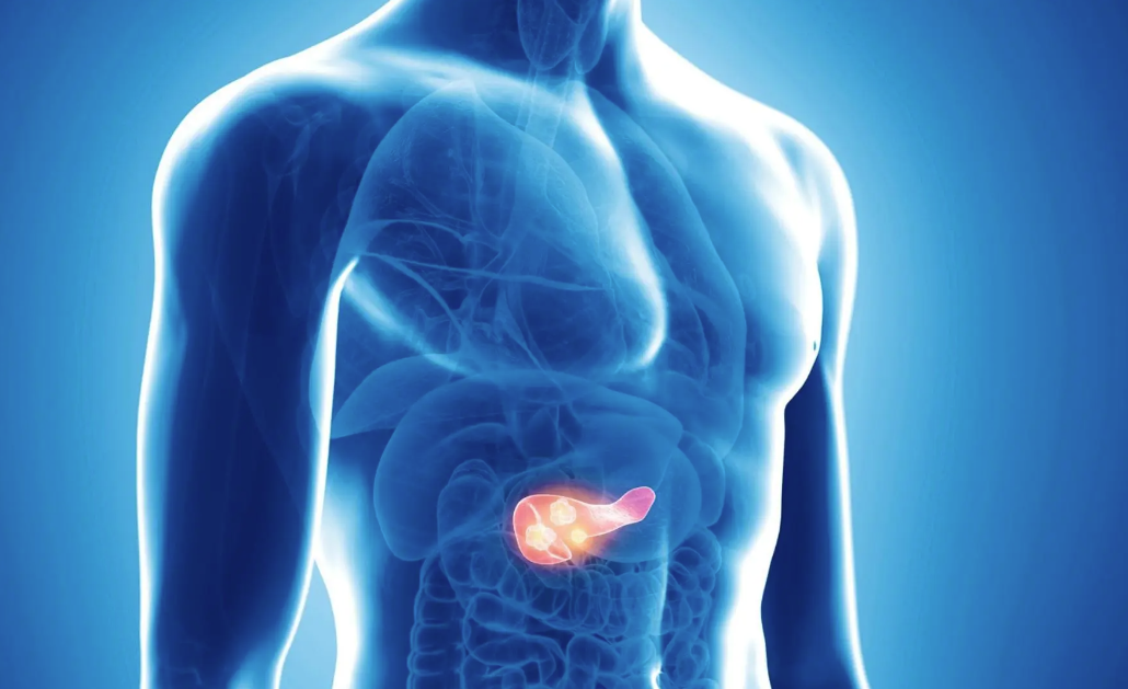Pancreatite: conheça a doença que tem crescido no Brasil