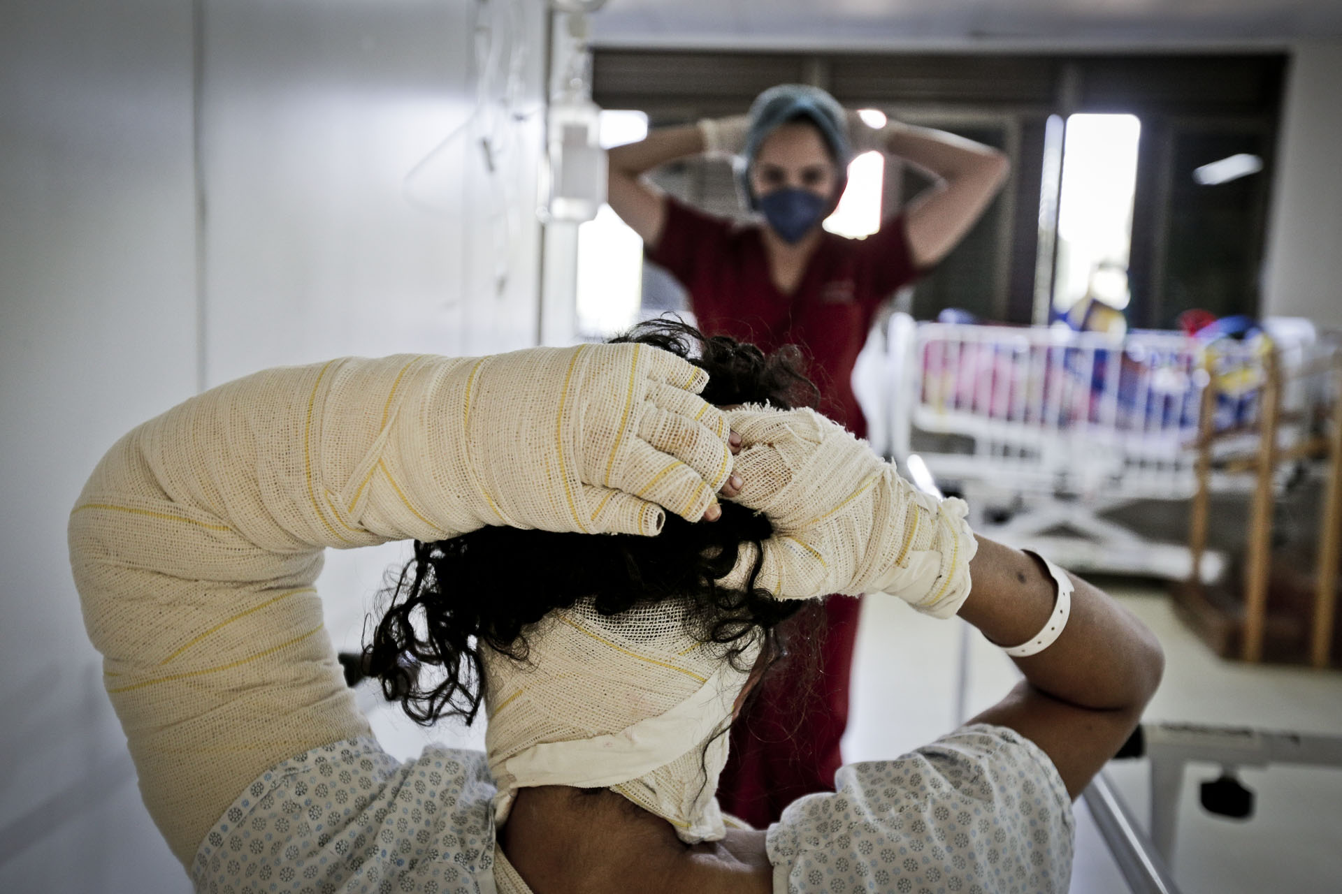 Queimaduras: veja como proteger crianças de acidentes graves