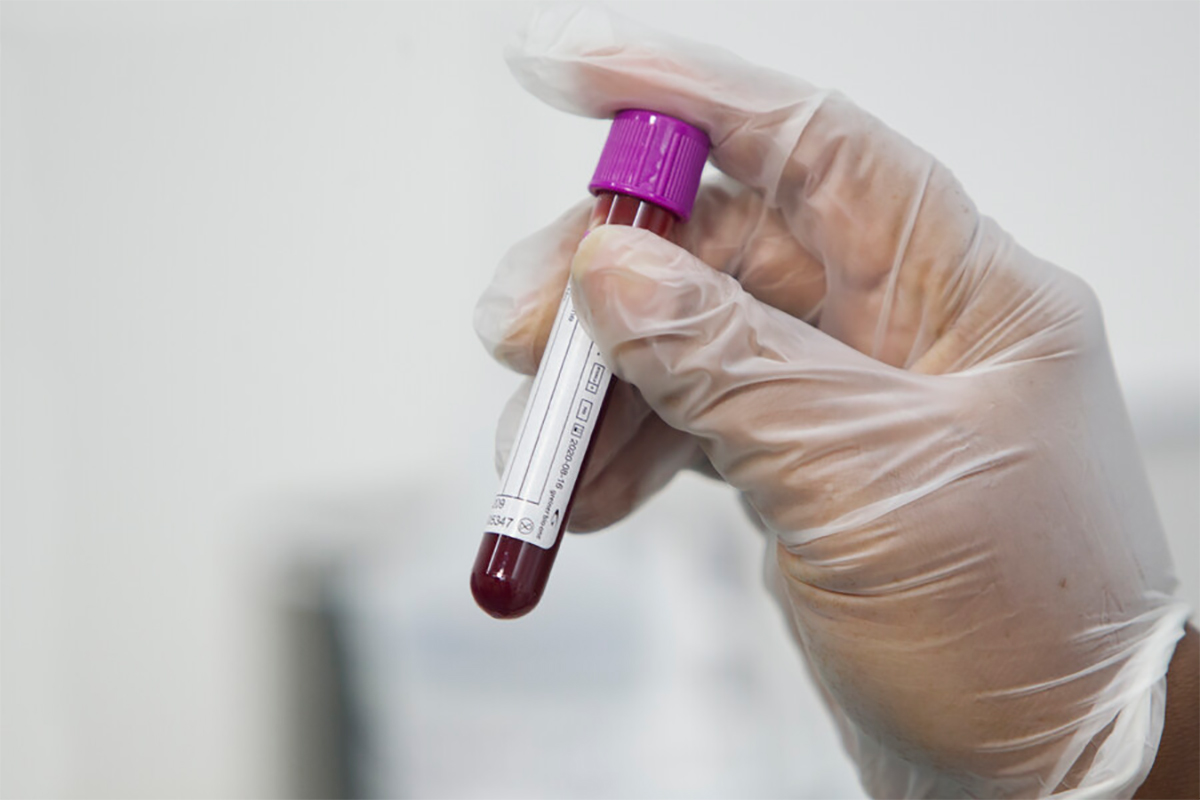 Estudo com medicamento para lesões na medula espinhal é liberado pela Anvisa