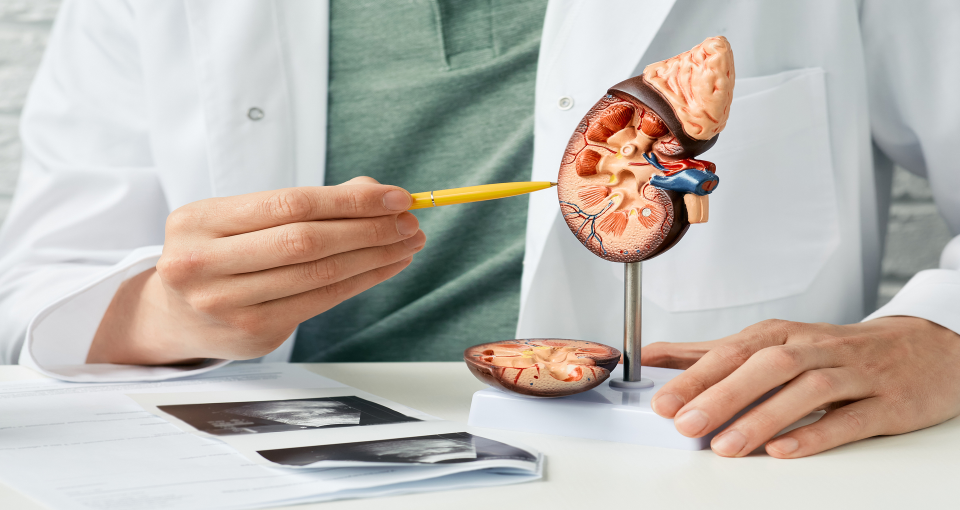 Doença renal crônica já afeta mais de 700 milhões de pessoas no mundo