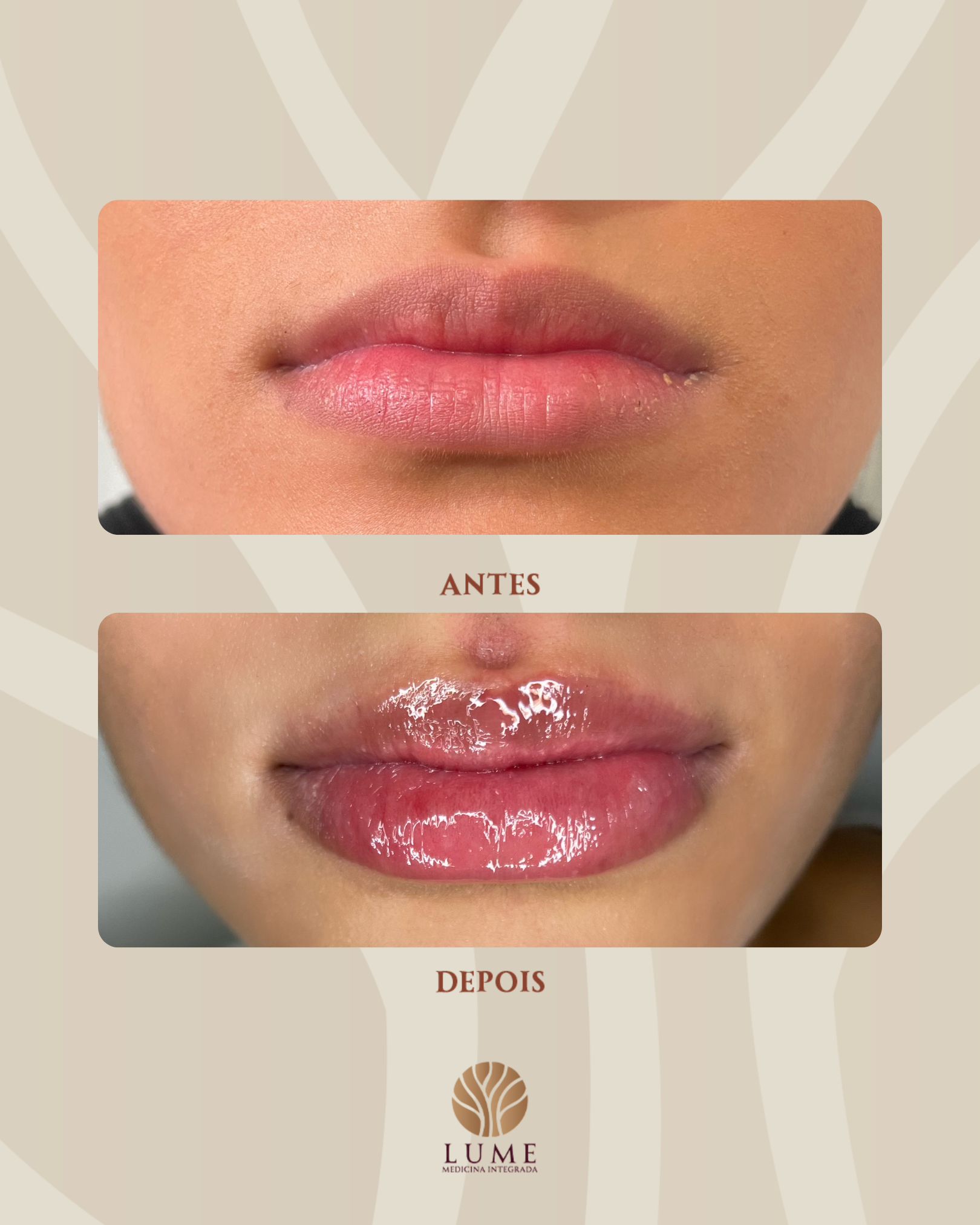 Além da estética: procedimentos que enaltecem a beleza e aumentam a autoconfiança