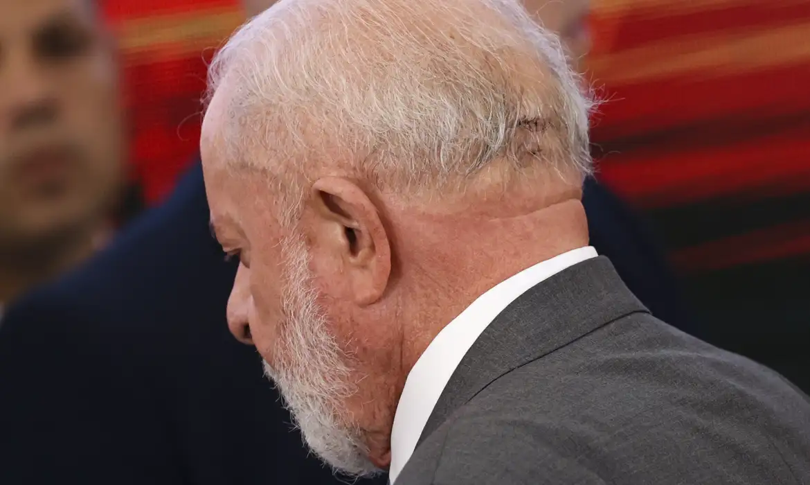 Entenda o que é trepanação, procedimento pelo qual Lula passou