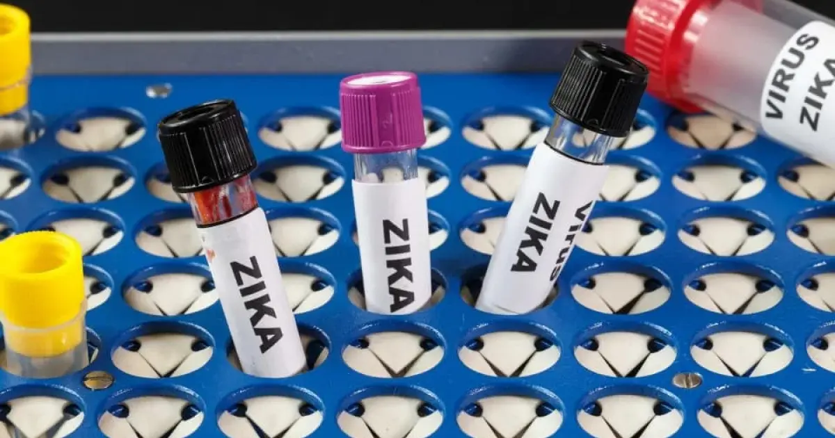 Desenvolvimento de vacinas brasileiras contra o Zika enfrenta desafios, mas avança em fase experimental