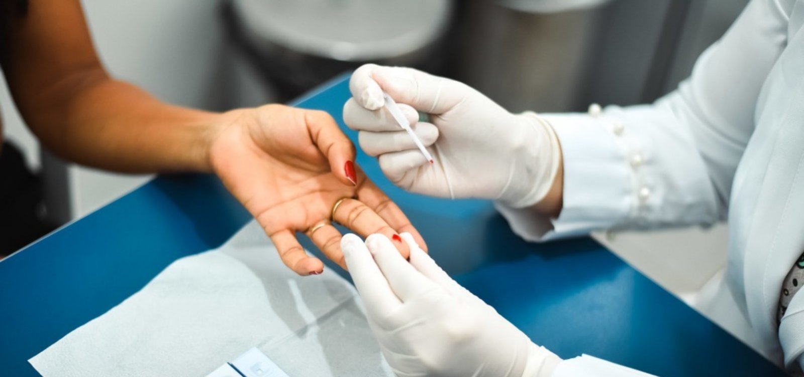 Casos de hepatite A crescem 400% na Bahia entre 2021 e 2025