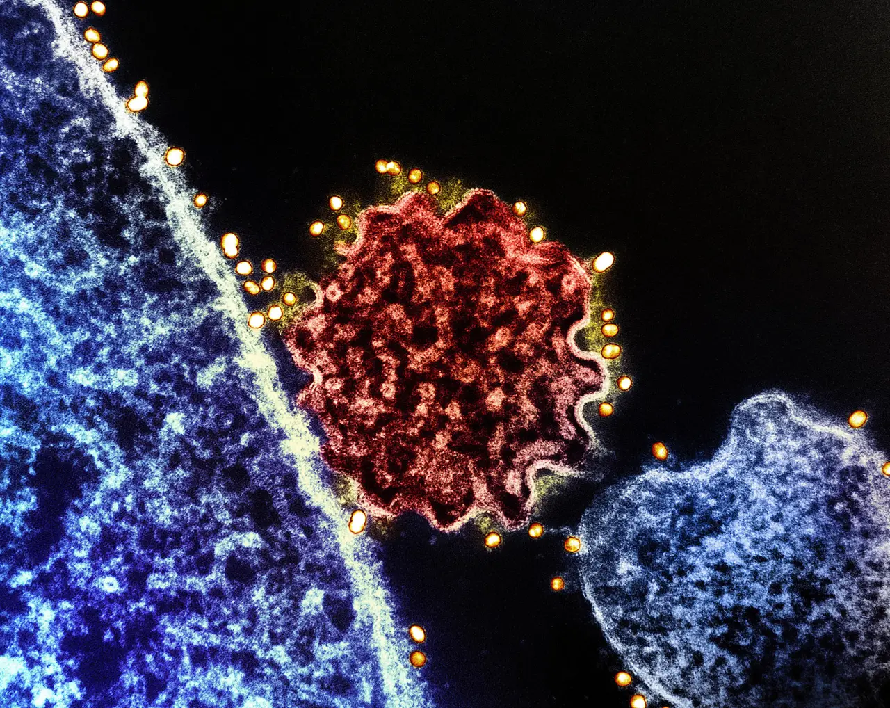 Vírus Nipah acende alerta internacional